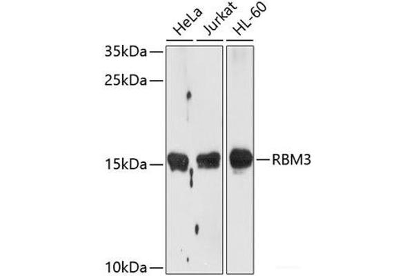 RBM3 antibody