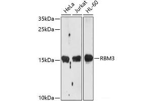 Western blot analysis of extracts of various cell lines using RBM3 Polyclonal Antibody at dilution of 1:1000. (RBM3 antibody)