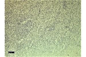 (ABIN185639) Negative Control showing staining of paraffin embedded Human Spleen, with no primary antibody. (Leptin Receptor antibody  (Internal Region))