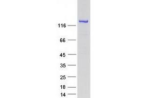 Western Blotting (WB) image for Inositol Polyphosphate-5-Phosphatase F (INPP5F) (Transcript Variant 1) protein (Myc-DYKDDDDK Tag) (ABIN2723487)