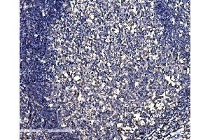 IHC analysis of SNAP23 using anti-SNAP23 antibody (ABIN7603236). (SNAP23 antibody  (N-Term))