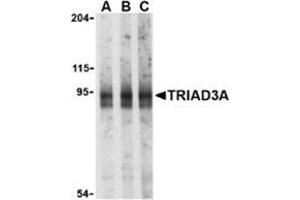 Western blot analysis of TRIAD3A in mouse heart cell lysates with this product at (A) 0.