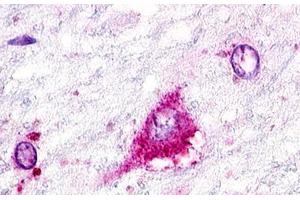 Image no. 1 for anti-G Protein-Coupled Receptor 22 (GPR22) (Cytoplasmic Domain) antibody (ABIN1048780) (GPR22 antibody  (Cytoplasmic Domain))