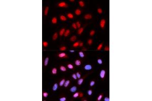 Immunofluorescence (IF) image for anti-Replication Factor C (Activator 1) 4, 37kDa (RFC4) antibody (ABIN1876673) (RFC4 antibody)
