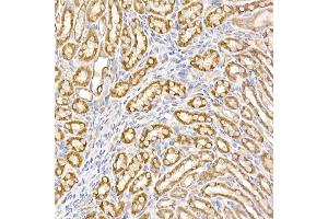 Immunohistochemistry of paraffin-embedded mouse kidney using UQCRH Rabbit mAb (ABIN7271126) at dilution of 1:50 (40x lens). (UQCRH antibody)