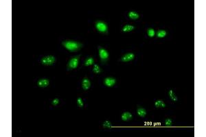 Immunofluorescence of monoclonal antibody to ZNF136 on HeLa cell. (ZNF136 antibody  (AA 444-540))