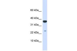 WB Suggested Anti-UBE2D2 Antibody Titration:  0. (UBE2D2 antibody  (Middle Region))