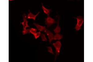 ABIN6275676 staining HeLa by IF/ICC. (CACNG1 antibody  (Internal Region))