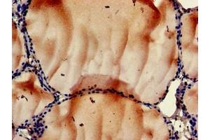 Immunohistochemistry of paraffin-embedded human thyroid tissue using ABIN7168188 at dilution of 1:100 (MSK1 antibody  (AA 224-367))