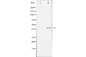 Western Blotting (WB) image for anti-Mitogen-Activated Protein Kinase 14 (MAPK14) (pTyr182) antibody (ABIN2843704)
