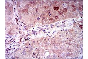 Immunohistochemistry (IHC) image for anti-Enolase 2 (Gamma, Neuronal) (ENO2) (AA 251-433) antibody (ABIN1846262) (ENO2/NSE antibody  (AA 251-433))