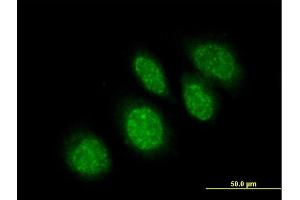 Immunofluorescence of purified MaxPab antibody to RBBP9 on HeLa cell.