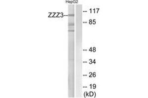 Western Blotting (WB) image for anti-Zinc Finger, ZZ-Type Containing 3 (ZZZ3) (AA 341-390) antibody (ABIN2890702) (ZZZ3 antibody  (AA 341-390))