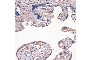 Immunohistochemistry of paraffin-embedded human placenta using IGF2 Rabbit pAb (ABIN3022872, ABIN3022873, ABIN3022874 and ABIN6219274) at dilution of 1:100 (40x lens). (IGF2 antibody  (AA 25-180))
