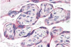 Human Placenta (formalin-fixed, paraffin-embedded) stained with ADORA2A antibody ABIN364458 at 1:50 followed by biotinylated goat anti-rabbit IgG secondary antibody ABIN481713, alkaline phosphatase-streptavidin and chromogen. (Adenosine A2a Receptor antibody  (AA 373-391))