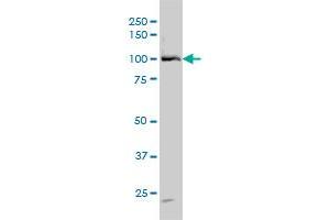 DDX54 monoclonal antibody (M01), clone 2H6 Western Blot analysis of DDX54 expression in HeLa .