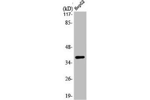 Western Blot analysis of HepG2 cells using L-type Ca++ CP γ7 Polyclonal Antibody (CACNG7 antibody  (C-Term))