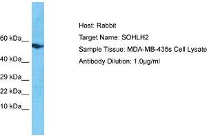 Host: Rabbit Target Name: SOHLH2 Sample Tissue: Human MDA-MB-435s Whole Cell Antibody Dilution: 1ug/ml (SOHLH2 antibody  (N-Term))