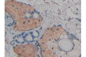 Detection of FABP9 in Rat Skin Tissue using Polyclonal Antibody to Fatty Acid Binding Protein 9, Testis (FABP9) (FABP9 antibody  (AA 1-130))