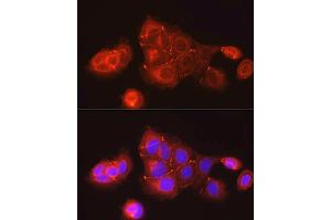 Immunofluorescence analysis of MCF7 cells using ZO-1 Rabbit pAb (ABIN1513706, ABIN3021026, ABIN3021027 and ABIN6213922) at dilution of 1:150 (40x lens). (TJP1 antibody  (AA 1600-1700))