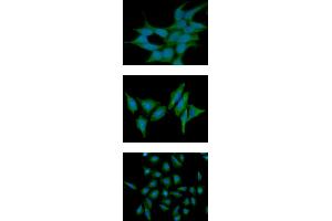 ICC/IF analysis of ST13 in 293T cells line, stained with DAPI (Blue) for nucleus staining and monoclonal anti-human ST13 antibody (1:100) with goat anti-mouse IgG-Alexa fluor 488 conjugate (Green). (HSC70 Interacting Protein HIP antibody  (AA 1-369))