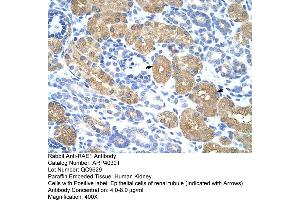 Rabbit Anti-RAE1 Antibody  Paraffin Embedded Tissue: Human Kidney Cellular Data: Epithelial cells of renal tubule Antibody Concentration: 4. (RAE1 antibody  (C-Term))
