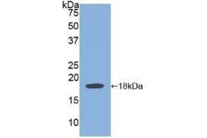 Detection of Recombinant BMP15, Human using Polyclonal Antibody to Bone Morphogenetic Protein 15 (BMP15) (BMP15 antibody  (AA 266-388))