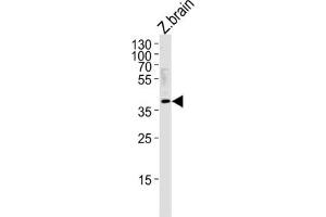 Western Blotting (WB) image for anti-Hairy/enhancer-of-Split Related with YRPW Motif 2 (HEY2) antibody (ABIN3004672) (HEY2 antibody)