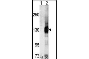Western blot analysis of CASK (arrow) using Cask Antibody (C-term) (ABIN391318 and ABIN2841347). (CASK antibody  (C-Term))
