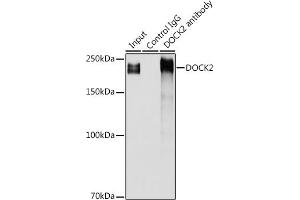 Immunoprecipitation analysis of 300 μg extracts of Jurkat cells using 3 μg DOCK2 antibody (ABIN1679578, ABIN5664348 and ABIN5664349). (DOCK2 antibody  (AA 1551-1830))
