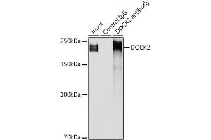Immunoprecipitation analysis of 300 μg extracts of Jurkat cells using 3 μg DOCK2 antibody (ABIN1679578, ABIN5664348 and ABIN5664349).