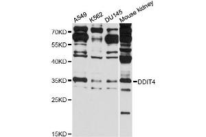 Western blot analysis of extracts of various cell lines, using DDIT4 antibody (ABIN6292397) at 1:1000 dilution.