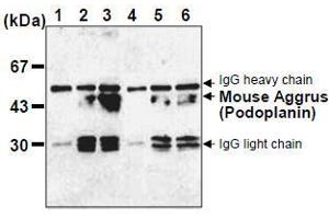Western Blotting (WB) image for anti-Podoplanin (PDPN) antibody (ABIN1449217)