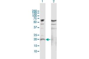Western Blot analysis of IL19 expression in transfected 293T cell line by IL19 MaxPab polyclonal antibody. (IL-19 antibody  (AA 1-215))