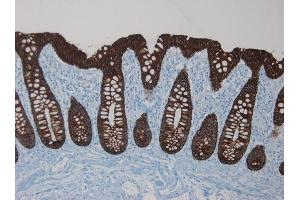 Immunohistochemistry on paraffin section of human colon