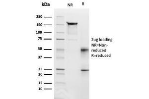 SDS-PAGE Analysis Purified CD95 Mouse Monoclonal Antibody (FAS/3112). (FAS antibody  (AA 26-96))