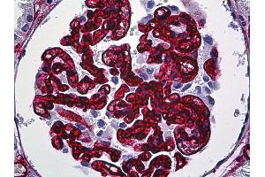 Anti-CD34 antibody IHC of human kidney, glomeruli. (CD34 antibody)