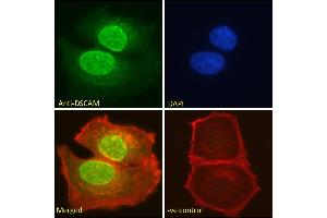 ABIN185687 Immunofluorescence analysis of paraformaldehyde fixed MCF7 cells, permeabilized with 0. (DSCAM antibody  (Internal Region))
