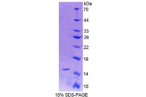 SDS-PAGE (SDS) image for Oxytocin, Prepropeptide (OXT) (AA 20-124) protein (His tag) (ABIN6239510) (OXT Protein (AA 20-124) (His tag))