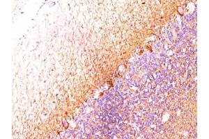 Formalin-fixed, paraffin-embedded human cerebellum stained with Neurofilament antibody (RT-97 + NR-4). (Neurofilament antibody)