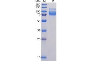 Human SIGLEC10 Protein, His Tag on SDS-PAGE under reducing condition. (SIGLEC10 Protein (His tag))