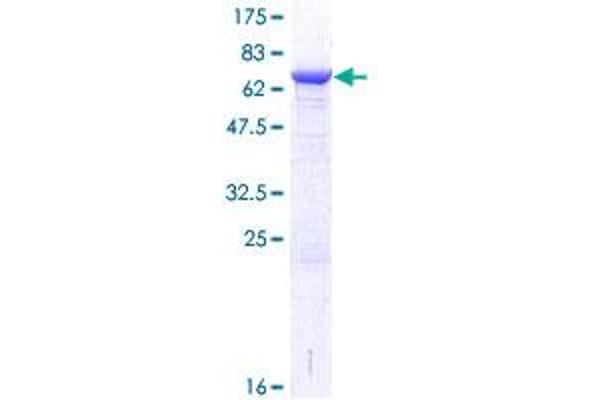 CHKB Protein (AA 1-395) (GST tag)