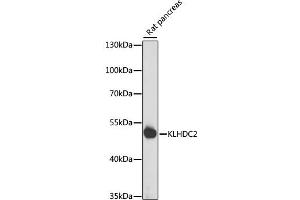 Western blot analysis of extracts of rat pancreas, using KLHDC2 antibody  at 1:1000 dilution. (KLHDC2 antibody  (AA 1-240))