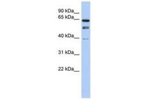 Image no. 1 for anti-MYST Histone Acetyltransferase 2 (MYST2) (N-Term) antibody (ABIN6740262) (MYST2 antibody  (N-Term))