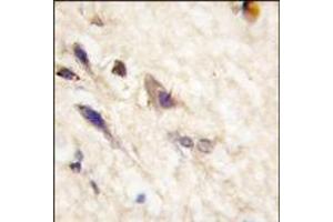 Formalin-fixed and paraffin-embedded human brain tissue reacted with EphA5 antibody (N-term), which was peroxidase-conjugated to the secondary antibody, followed by DAB staining. (EPH Receptor A5 antibody  (N-Term))