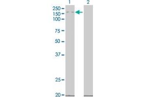 Western Blot analysis of MAP3K5 expression in transfected 293T cell line by MAP3K5 monoclonal antibody (M03), clone 2D11. (ASK1 antibody  (AA 1231-1374))