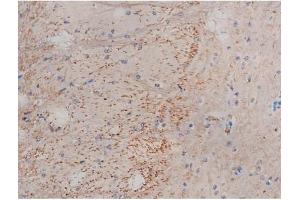 ABIN6267353 at 1/200 staining Mouse brain tissue sections by IHC-P. (MAPT antibody  (pSer214))