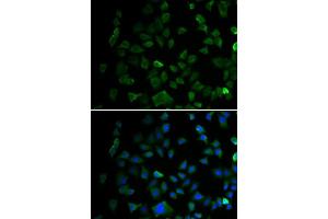 Immunofluorescence analysis of U2OS cells using MAP2K1 antibody. (MEK1 antibody  (AA 1-100))
