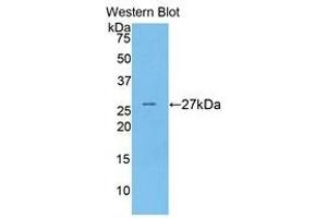 Western Blotting (WB) image for anti-Coagulation Factor IX (F9) (AA 241-463) antibody (ABIN1858772) (Coagulation Factor IX antibody  (AA 241-463))