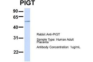 Host:  Rabbit  Target Name:  PIGT  Sample Type:  Human Adult Placenta  Antibody Dilution:  1. (PIGT antibody  (C-Term))